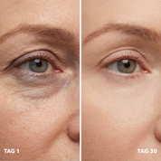 Eye Care & Glow Bundle