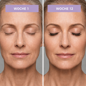 Wachstumsserum für Wimpern